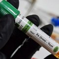 Višak gvožđa može ozbiljno da ugrozi zdravlje: Ovo su simptomi koje ne treba ignorisati