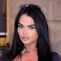 Transrodnoj Srpkinji doktori spojili silikone: Smršala 80 kilograma, sad pokazala figuru i ljudi su u neverici
