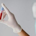 Zapošljavanje najboljih 100 diplomaca medicinskih fakulteta