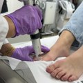 Šta, skinuli ste gel lak posle mora i ugledali žut nokat? Lekar savetuje šta tačno treba da uradite