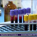 Nadutost nije uvek bezazlena: Kada je vreme za pregled lekara?