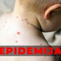 Epidemija morbila proglašena u Novom Pazaru: Bolest potvrđena i kod trećeg deteta