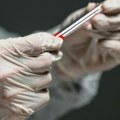 Zabrinutost u SAD: Pojavila se bakterija otporna na lekove, nosioci mogu biti asimptomatski