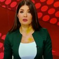 (Foto) svi bruje o žutim mrljama na voditeljki RTS: Gordana vodila "Dnevnik", pa se digla prašina na mrežama: Evo šta ona…