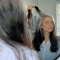 Kako nekima kosa posedi već u tinejdžerskom dobu