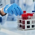 Poziv građanima da se odazovu i daju krv: Institut za transfuziju obeležava 82 godine postojanja
