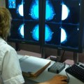AI skrining ubrzava detekciju kancera i smanjuje obaveze radiologa