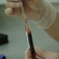 Besplatno testiranje na HIV u Zavodu za javno zdravlje Zrenjanin
