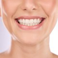 Jedno od čestih pitanja stomatoloških pacijenata je: "Posle koliko vremena od vađenja zuba mogu da ugradim implant?"