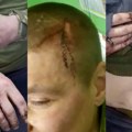 Regruti elitnog puka „Skala" umirali pre fronta