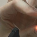 Sve više ljudi se suočava sa problemom kratkovidosti i dalekovidosti