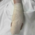 Дечаку из Ниша ампутиран прст након напада вршњака – мајка тврди да је ударен металном шипком