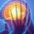 U početku liči na običan virus, a za nekoliko sati može biti fatalan: Neurolog upozorava na glavobolju koju izaziva opasan…