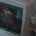 Akcija preventivnih pregleda nastavljena u Velikim Pčelicama