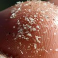 Mikroplastika se nalazi i u našim arterijama