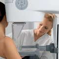 Kontrola svake dve godine: Dom zdravlja "Novi Sad" poziva žene da se prijave na mamografske preglede