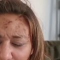 Ani Nikolić lice i telo u ranama, a majica krvava: Objavila šok snimak nakon haosa sa Raletom: Hvata se za glavu, zapomaže…