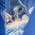 Čovek u Kini živeo više od 170 dana nakon transplantacije svinjske jetre