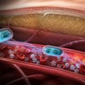 Naučnici izumeli implantat koji može da pomogne u lečenju dijabetesa tipa 2
