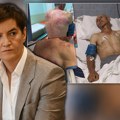 "Ovo je Nenad Rašković kog je u kući pretukla tzv. kosovska policija" Brnabić najoštrije osudila prebijanje Srbina na KiM…