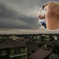 Ivana zadobila jezive povrede nakon superćelijske oluje u Srbiji! Doktor nije verovao - cela krvava i u modricama (foto)