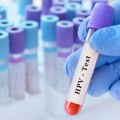 Svaka osma žena u Srbiji ima HPV: Stručnjaci upozoravaju na značaj pregleda