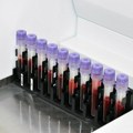 Laboratorijske analize u starijem dobu: Koji nalazi su važni i kako pravilno tumačiti rezultate