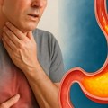 Od gorušice do ozbiljnog oštećenja jednjaka: 5 zabluda o hroničnom refluksu
