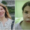 Jovana je 20 godina mislila da pati od alergije, a onda je saznala da ima redak sindrom zbog kog nekontrolisano otiče: Napad…