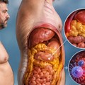 Skriveni uzorčnik niskog testosterona utiče na njegov pad više nego starenje