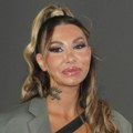 Sve je novo, čelo, brada, usne i jagodice: Aneli Ahmić pre i posle "remonta", evo kako troši 50.000 evra (foto)