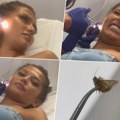 Virile mu samo nožice: Lepa Katalonka došla u bolnicu zbog krvarenja iz uha, lekar izvukao ogromnog moljca (video)