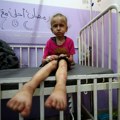 UN stavlja Izrael na ‘Listu srama’ zbog stradanja djece u Gazi
