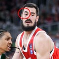 Detalj koji je svima promakao: Nikola Kalinić igrao protiv Cedevite sa modricom ispod oka