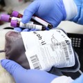 „Zlatna krv“: Zašto je Rh nulta krv najtraženija i kako nučnici pokušavaju da je kloniraju u laboratoriji