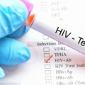 Tri žene u Novom Meksiku zaražene HIV-om, prve su koje su na ovaj način dobile virus