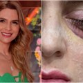 Popila je ibuprofen zbog menstrualnih bolova pa završila u komi