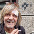 Žika Todorović bez prednjeg zuba, rana na glavi: Slika glumca zabrinula: "Posle nesporazuma sam baraba"