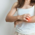 Sistemski eritemski lupus: Kad imuni sistem napada telo