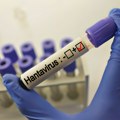 Institut Batut o hantavirusu: Za 10 godina 127 slučajeva u Srbiji