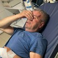 Kancelarija za KiM: Svetu Ilića iz sela Binač u Kosovskom pomoravlju pretukao Albanac (foto)