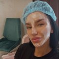 (Фото) Александра Николић након порођаја на ремонту лица: Задругарка показала резултате третмана: Ево како сада изгледа