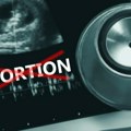 Džordžija ponovo uvela zabranu abortusa posle šest nedelja trudnoće