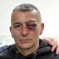 Ko je udario u oko policajca Lazara Bačića?