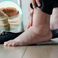 Teške i otečene noge nisu samo posledica vrućine: Evo šta može da pomogne cirkulaciji