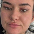 'Ne mogu da zatvorim oči': Žene upozoravaju na jeftine zahvate na kapcima