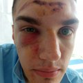 Optužbe o nasilju policije: Svedočenja povređenih na blokadama u Srbiji