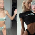 Violeta ima samo 32 kilograma i tvrdi da nije anoreksična: Kaže da redovno ide kod lekara, a evo šta je uzrok njenoj…