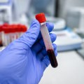 Ebola ne posustaje u Kongu: Više od 2.700 ljudi izgubilo život