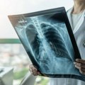 Simptomi raka pluća koji se javljaju i kod nepušača